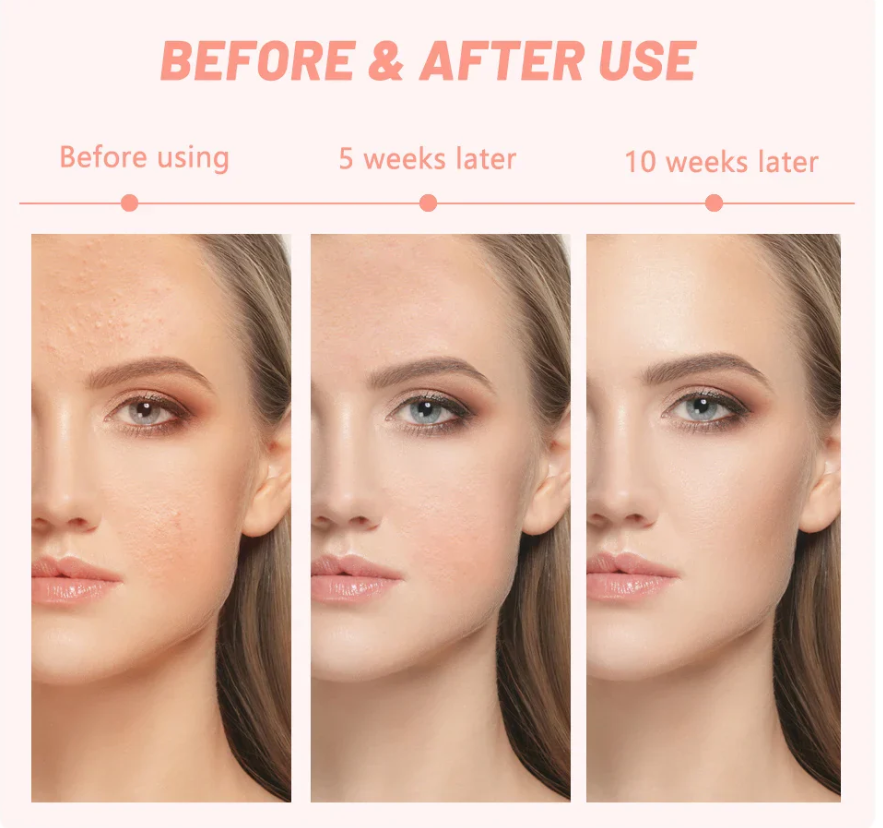Máscara LED con Cuello 7 Colores + Microcorrientes: Fototerapia Facial Profesional en Casa